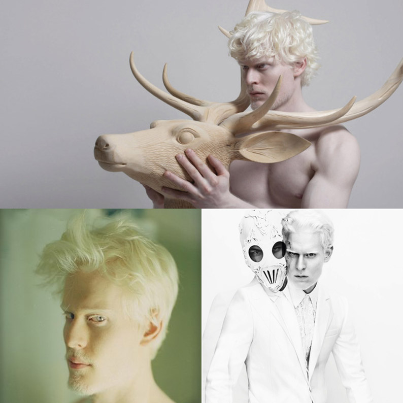 albino-male-model_-stephen-thompson.jpg